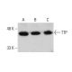 western blotting image from recommended TTP (A-8) monoclonal antibody replacement. Image 376902