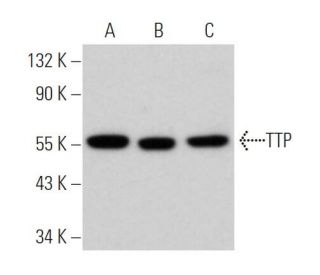 TTP Antibody (H-12) - Western Blotting - Image 361595The Double Nickase Plasmid features a U6 promoter for sgRNA expression, a 20 nt targeting sequence, and a gRNA scaffold to guide Cas9n. It includes a CBh promoter for Cas9n (D10A) and puromycin resistance, GFP for transfection verification, and nuclear localization signals (NLS). The 2A peptide allows co-expression of Cas9n and Puro from a single promoter, enabling precise genome editing with reduced off-target effects.