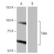 Tuba Antibody (MH-8) - Western Blotting - Image 65085