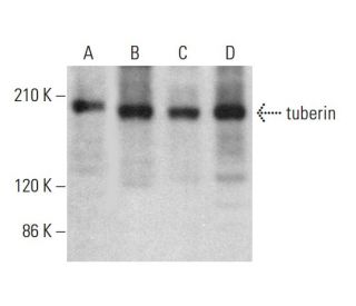 tuberin Antibody (B-5) - Western Blotting - Image 378450 