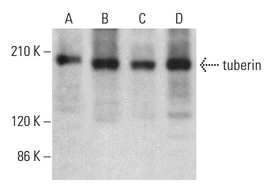 tuberin Antibody (B-5): sc-271314