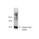 tuberin Antibody (E-9) - Western Blotting - Image 138287