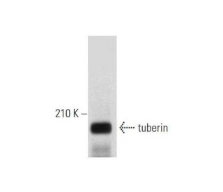 tuberin Antibody (E-9) - Western Blotting - Image 318595 