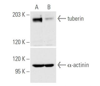 tuberin siRNA (h): sc-36762. Western blot analysis of tuberin expression in non-transfected control (A) and tuberin siRNA 