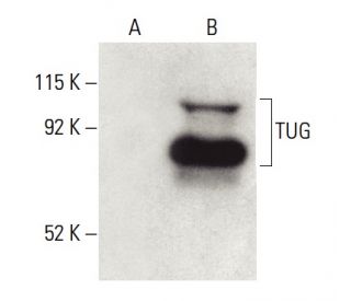 TUG Antibody (4A11A6G11) - Western Blotting - Image 399487 