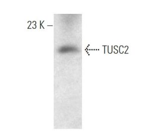 TUSC2 Antibody (1550CT388.74.12) - Western Blotting - Image 374605Each CRISPR/Cas9 Knockout (KO) Plasmid product consists of a pool of 3 plasmids designed to ensure identification and cleavage of a specific gene for maximum knockout efficiency. Each plasmid encodes a unique 20 nt sequence derived from the GeCKO (v2) library.
