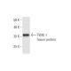 TWIK-1 Antibody (4D7) - Western Blotting - Image 348531