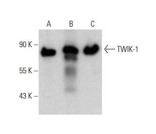 western blotting image from recommended TWIK-1 (4D7) monoclonal antibody replacement. Image 384240