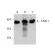 western blotting image from recommended TWIK-1 (4D7) monoclonal antibody replacement. Image 384240