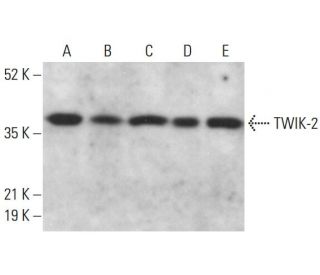 TWIK-2 Antibody (H-6) - Western Blotting - Image 378169 