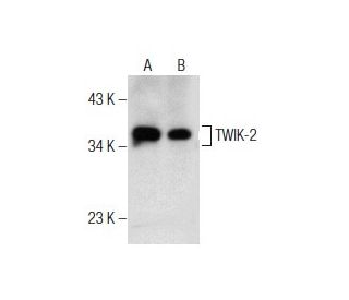 TWIK-2 Antibody (H-6) - Western Blotting - Image 155811