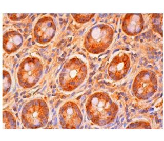 Twinfilin-1 Antibody (C-12) - Immunohistochemistry - Image 313927 