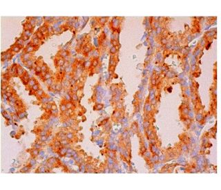 Twinfilin-1 Antibody (E-4) - Immunohistochemistry - Image 313934 