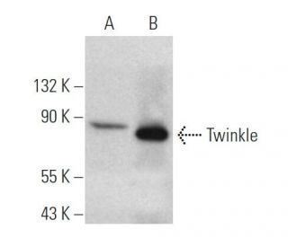 Twinkle Antibody (1C5) - Western Blotting - Image 374541 