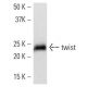 Este anticuerpo policlonal ha dejado de fabricarse. Consulta nuestro anticuerpo monoclonal recomendado <a href="twist-antibody-twist2c1a">twist (Twist2C1a)</a> (se muestran datos de muestra). western blotting image from recommended twist (Twist2C1a) monoclonal antibody replacement. Image 16826