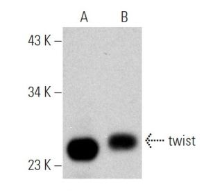 twist Antibody (Twist2C1a) - Western Blotting - Image 366608