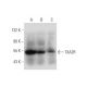 TXA2R Antibody (G-2) - Western Blotting - Image 333741