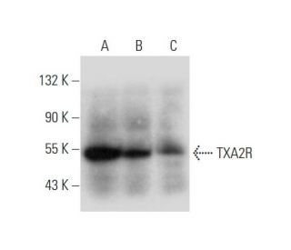 western blotting image from recommended TXA2R (G-2) monoclonal antibody replacement. Image 333741