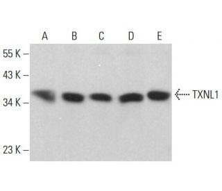 TXNL1 Antibody (F-6) - Western Blotting - Image 378211