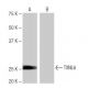 TXNL6 Antibody (3-RE25) - Western Blotting - Image 65086
