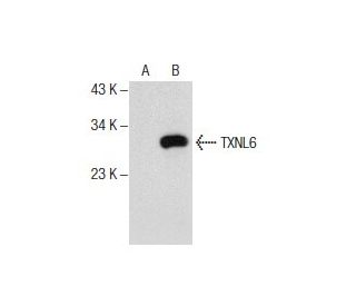 TXNL6 Antibody (3-RE25) - Western Blotting - Image 157793 