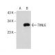 TXNL6 Antibody (3-RE25) - Western Blotting - Image 157793 