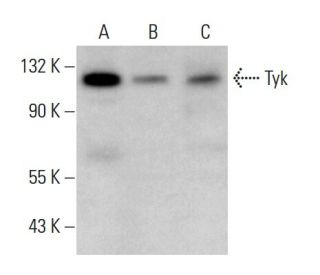 western blotting image from recommended Tyk 2 (C-8) monoclonal antibody replacement. Image 376135