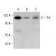 western blotting image from recommended Tyk 2 (C-8) monoclonal antibody replacement. Image 376135