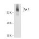 Tyk 2 Antibody (H-4) - Western Blotting - Image 83977 