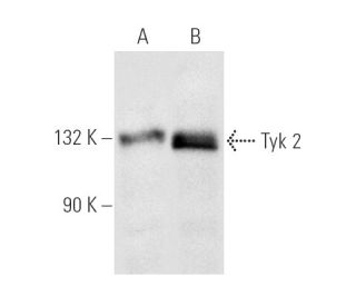 Tyk 2 Antibody (C-8) - Western Blotting - Image 2171