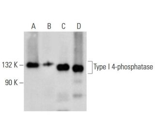 Type I 4-phosphatase Antibody (D-10) - Western Blotting - Image 289865 