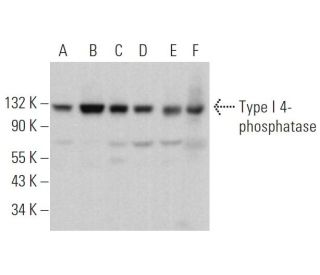 Type I 4-phosphatase Antibody (D-10) - Western Blotting - Image 371150