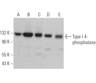 Type I 4-phosphatase Antibody (E-2) - Western Blotting - Image 371156 