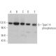 Type I 4-phosphatase Antibody (E-2) - Western Blotting - Image 371156 