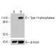 Type I 4-phosphatase Antibody (E-2) - Western Blotting - Image 415082