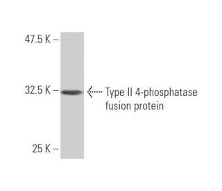Type II 4-phosphatase Antibody (3F2) - Western Blotting - Image 348978
