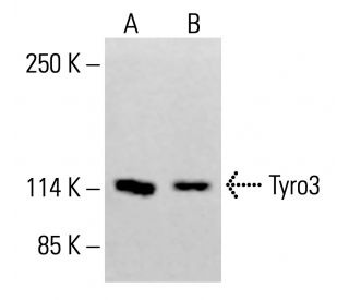 Tyro3 Antibody (1C11E8) - Western Blotting - Image 413368 