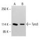 Tyro3 Antibody (1C11E8) - Western Blotting - Image 413368 