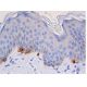 Tyrosinase Antibody (0.N.596) - Immunohistochemistry - Image 356395 