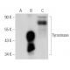 Tyrosinase Antibody (0.N.596) - Western Blotting - Image 30125