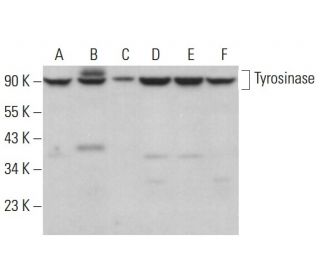 Tyrosinase Antibody (0.N.596) - Western Blotting - Image 379978 