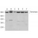 Tyrosinase Antibody (0.N.596) - Western Blotting - Image 379978 