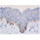 Tyrosinase Antibody (6A207) - Immunohistochemistry - Image 356396 