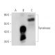 Tyrosinase Antibody (6A207) - Western Blotting - Image 30127