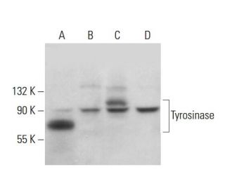 Tyrosinase Antibody (6A207) - Western Blotting - Image 379956 