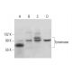 Tyrosinase Antibody (6A207) - Western Blotting - Image 379956 