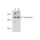 Tyrosinase Antibody (B-3) - Western Blotting - Image 319396 