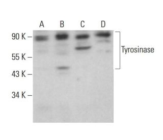 Tyrosinase Antibody (B-3) - Western Blotting - Image 379974 