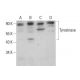 Tyrosinase Antibody (B-3) - Western Blotting - Image 379974 