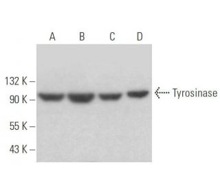 western blotting image from recommended Tyrosinase (T311) monoclonal antibody replacement. Image 352763